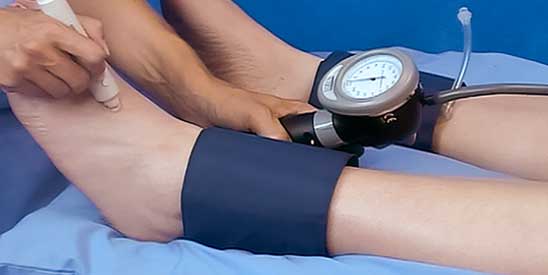 Ankle Brachial Index ankle pressure