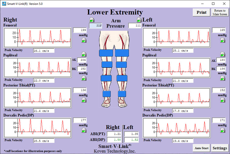 Segmental Pressures