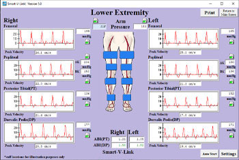Segmental Pressures