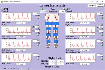 Segmental Pressures