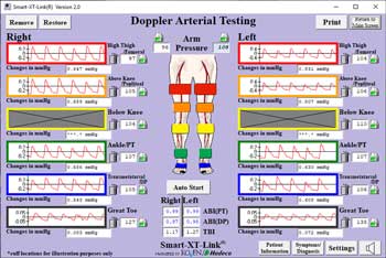 Segmental Pressures