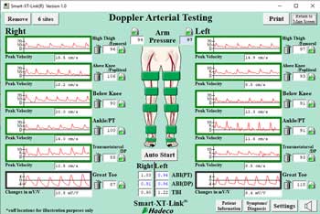 Segmental Pressures